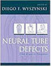 Neural Tube Defects From Origin to Treatment - Importado
