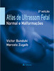 Atlas de Ultrassom Fetal: Normal e Malformações