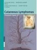 Cutaneous Lymphomas: Unusual Cases 2 - Importado