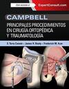 Campbell. Principales procedimientos en cirugía ortopédica y traumatología + ExpertConsult